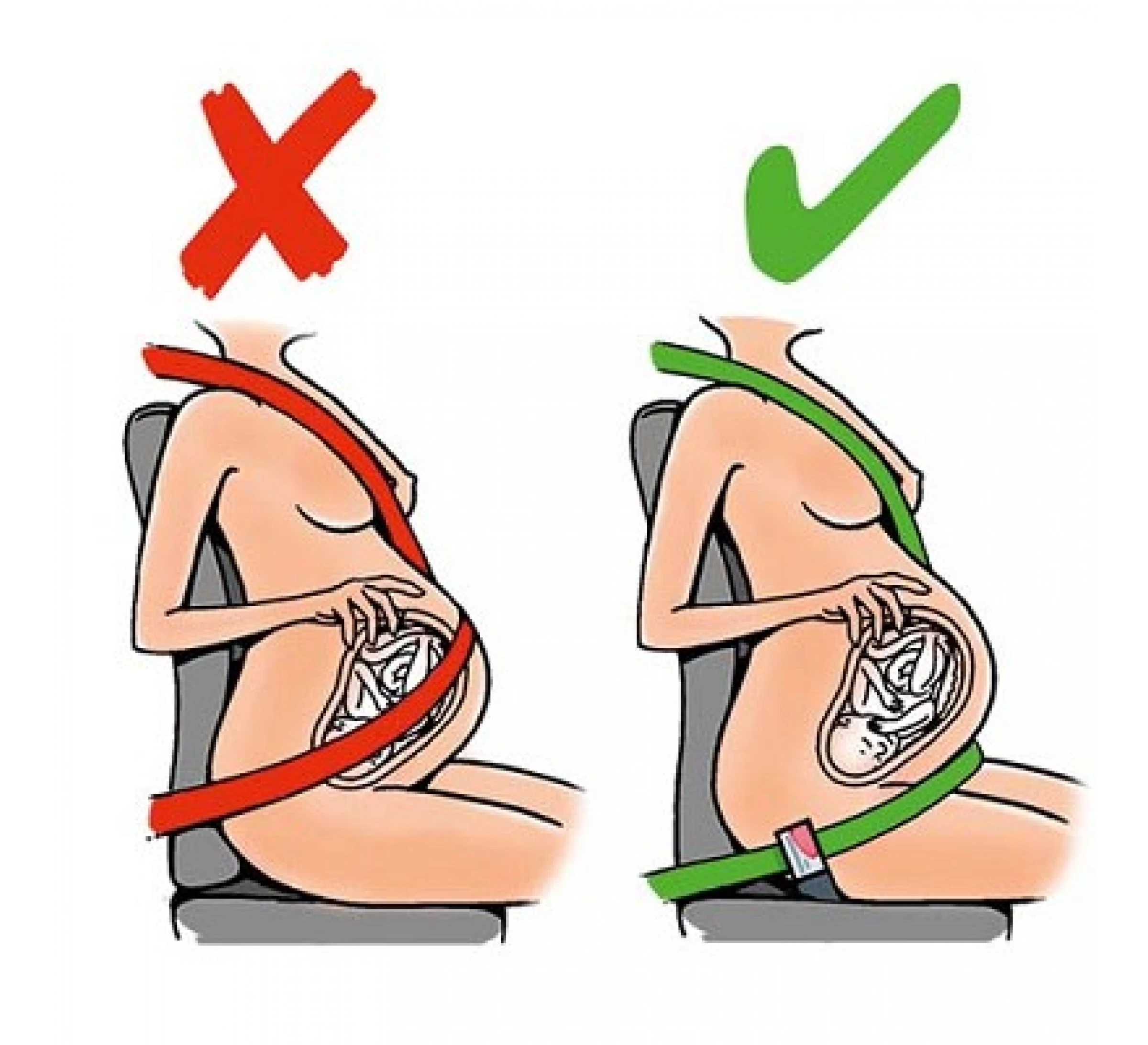 Gordelgeleider Voor Zwangeren 3 Gordelgeleider Voor Zwangeren